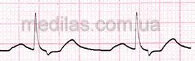 Форма сигналу ЕКГ у режимі генерації кардіоподібного сигналу